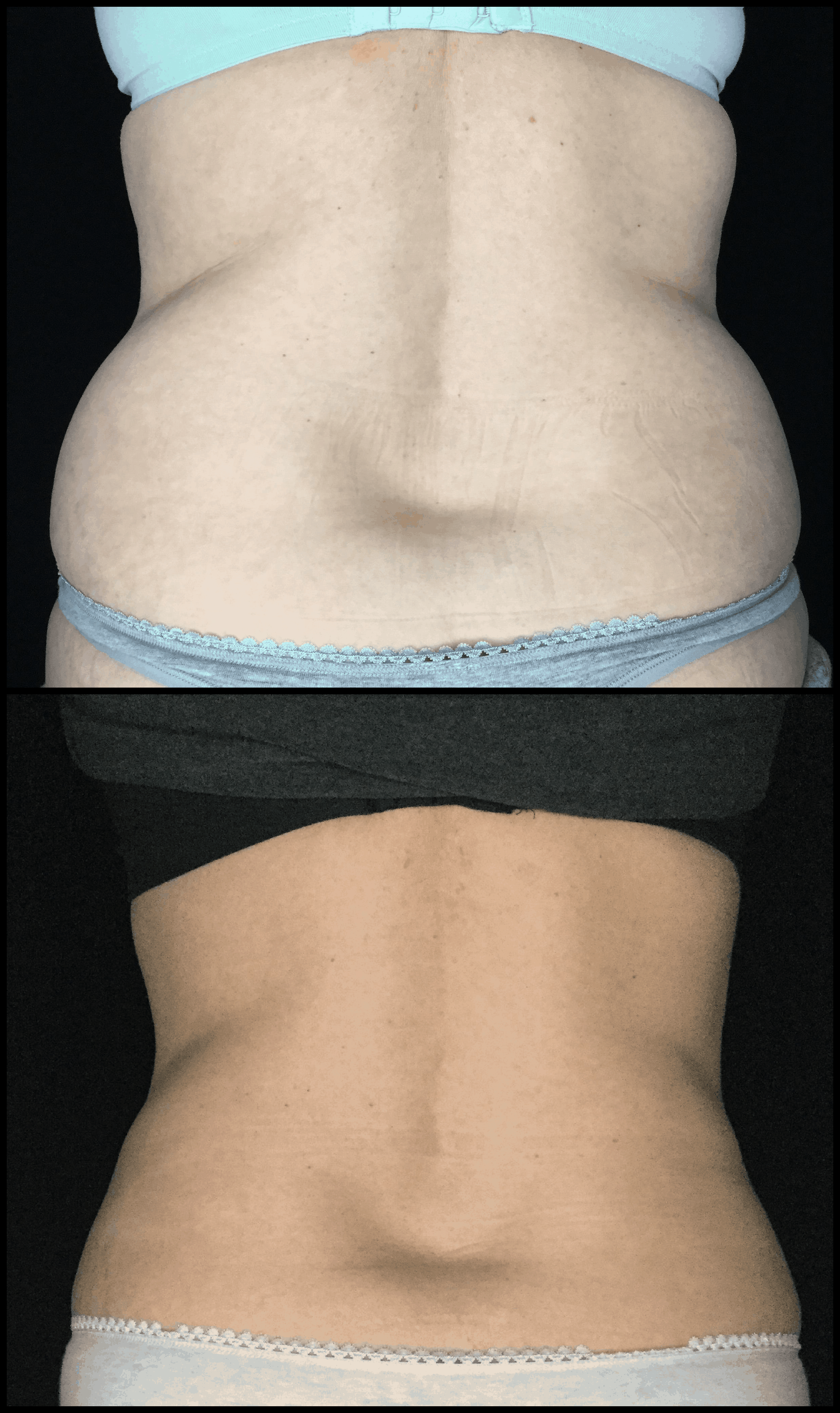 SHEER SCULPT COOLSCULPTING - 220 Wilmington West Chester Pike